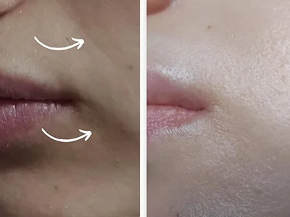 منتج طبيعي للعناية بالبشرة - سيروم فيتامين C